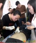 南宁精准针灸医学学习 广西针灸经络高级培训班 去南宁快康