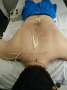 广西中医针灸推拿系统培训班 南宁针灸推拿拔罐刮痧艾灸培训专题