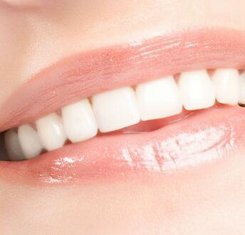 氟斑牙的美白价格贵吗