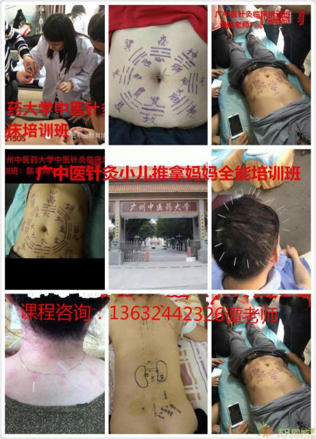 广州学习针灸推拿0基础学多久？