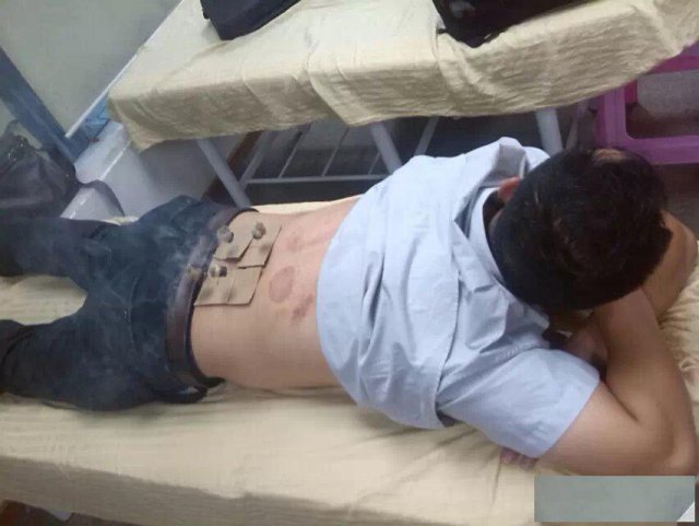 广州针灸培训，零基础学习中医针灸推拿