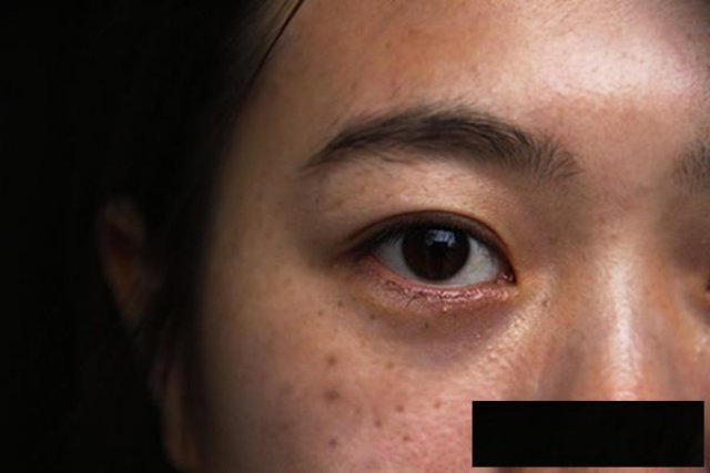 广州紫馨王慧瑛医生怎么样？王慧瑛技术如何？