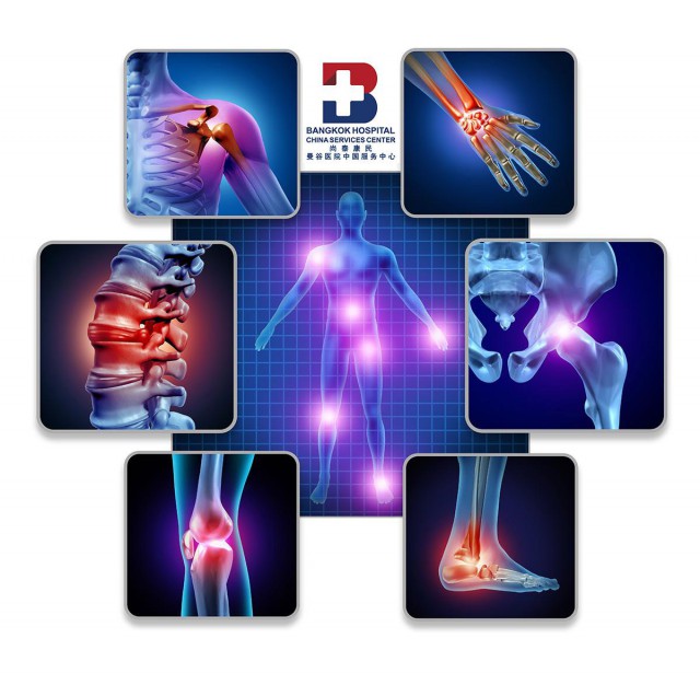 曼谷医院关节炎和风湿病中心银屑病关节炎可能导致永久性畸形