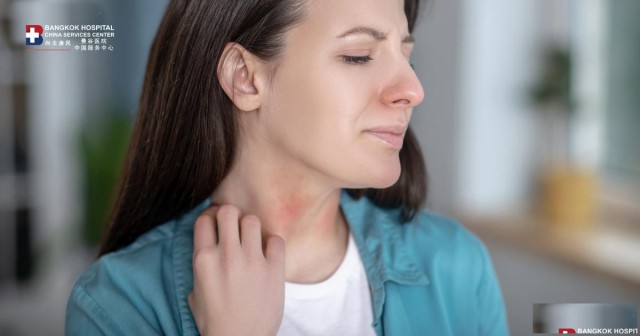 泰国曼谷医院过敏与哮喘中心|慢性荨麻疹