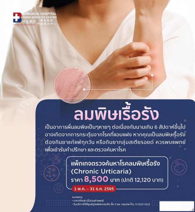 泰国曼谷医院慢性荨麻疹检测套餐