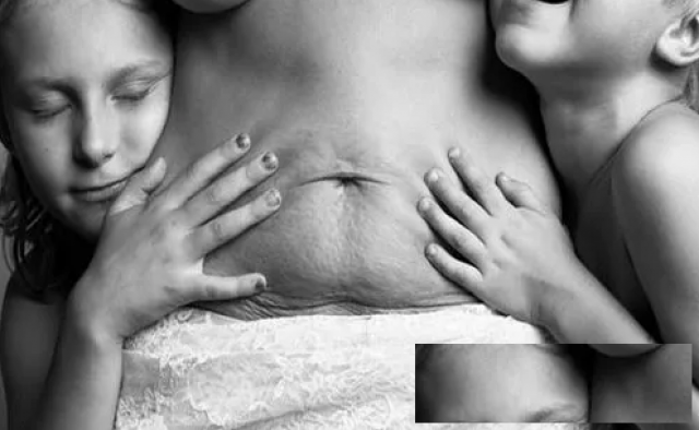 产后康复神器让妈妈们重拾自信