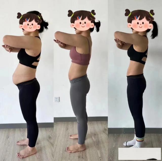 产后盆底肌修复：主动训练与被动训练