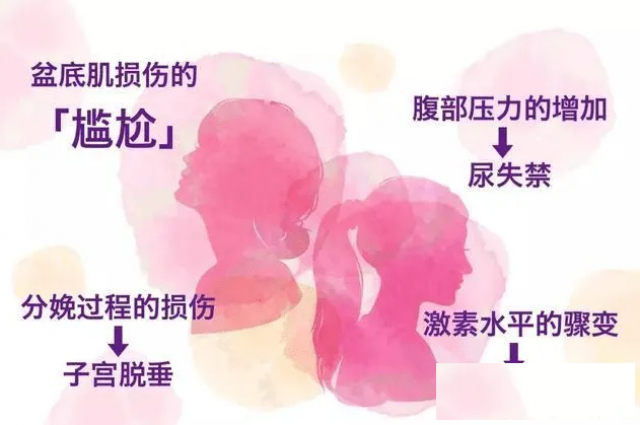 盆底肌修复，您想知道的干货都在这里！