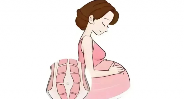 科学修复腹直肌分离，产后妈妈也能重拾平坦小腹！