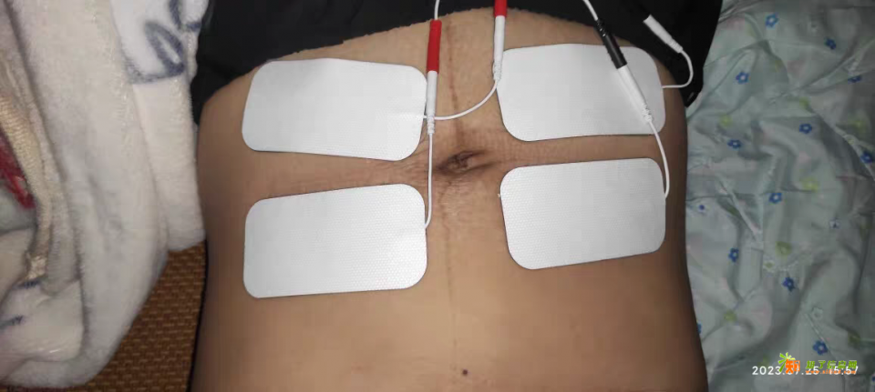 产后肚子松垮瘦不下？别急着跳操，先修复腹直肌这个“地基”！